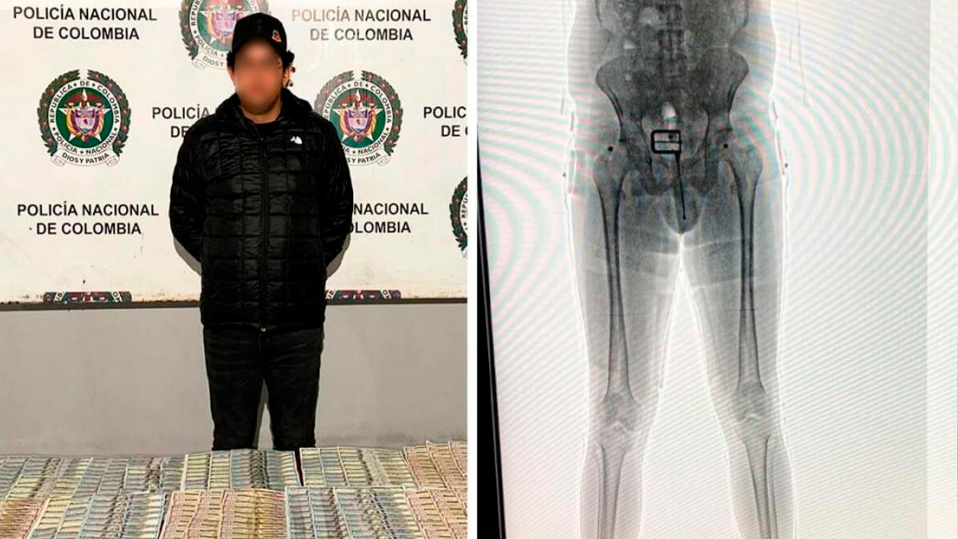 Capturan a hombre con 60.950 dólares ocultos en su ropa interior en el Aeropuerto El Dorado